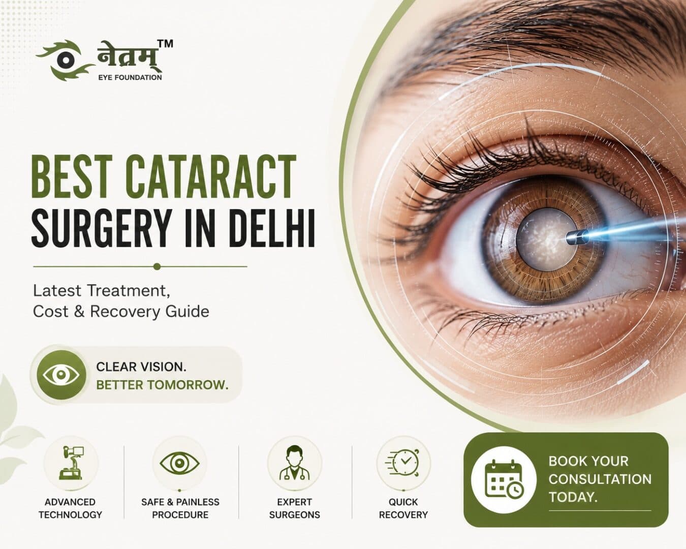 Best Cataract Surgery in Delhi